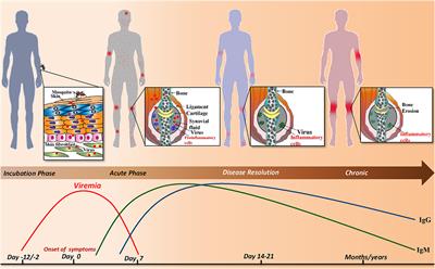 Disease Resolution in Chikungunya—What Decides the Outcome?